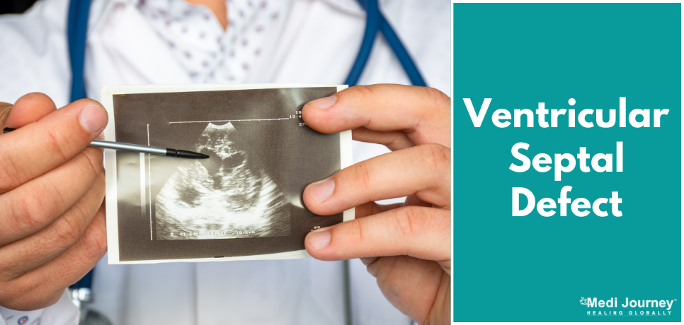 Ventricular Septal Defect: VSD Types, Causes, and Treatment