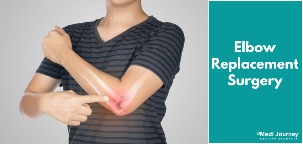 Elbow Replacement: Types, Procedure, and Recovery