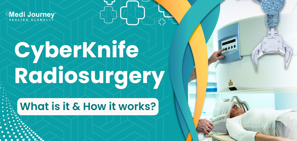 CyberKnife Radiosurgery: What it is and How it Works