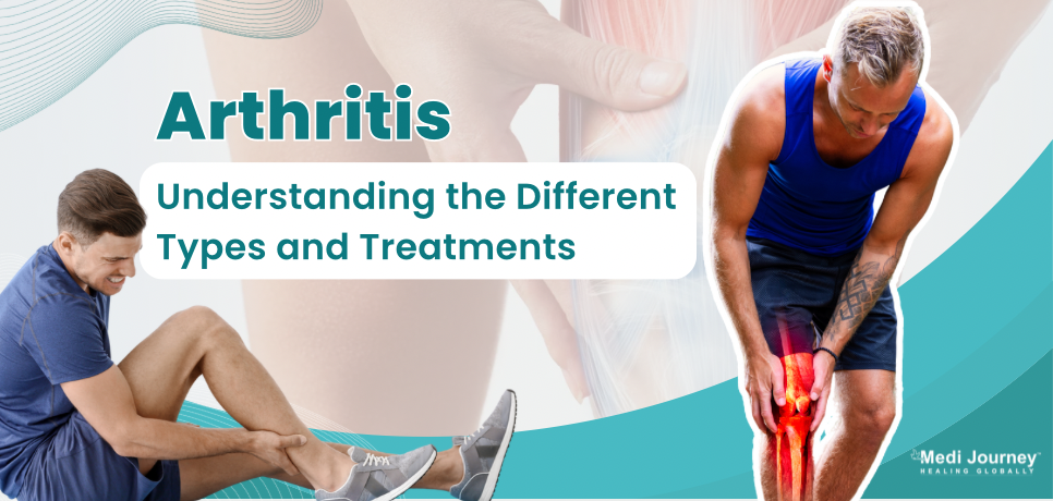 Arthritis 101: Understanding the Different Types and Treatments