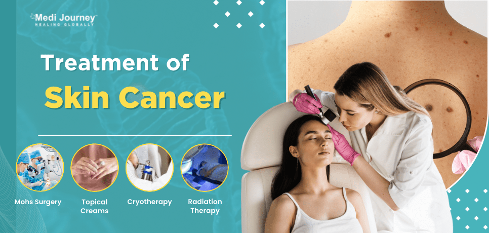 Treatment of skin cancer