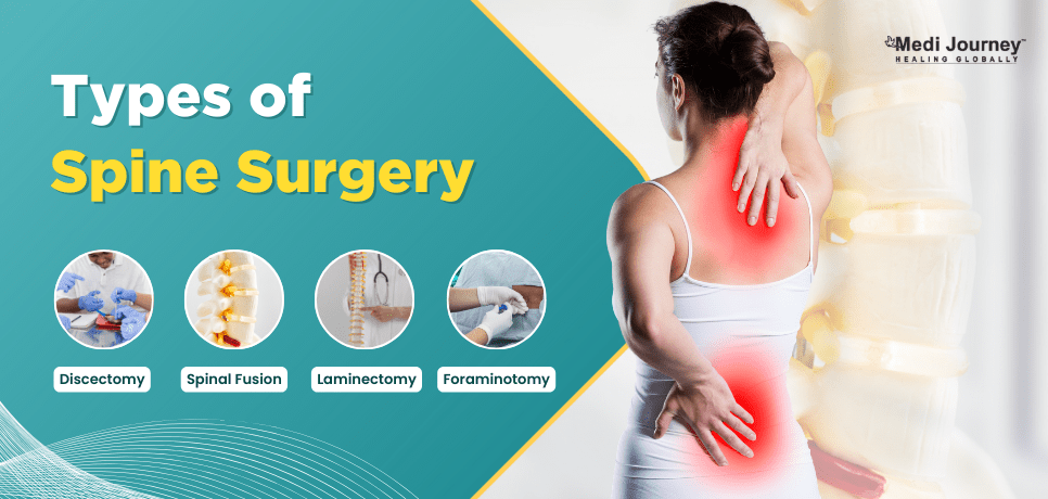 Types of spine surgery