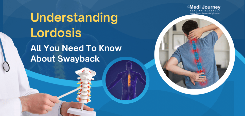 Lordosis (Swayback): Causes, Treatment, and Excercise