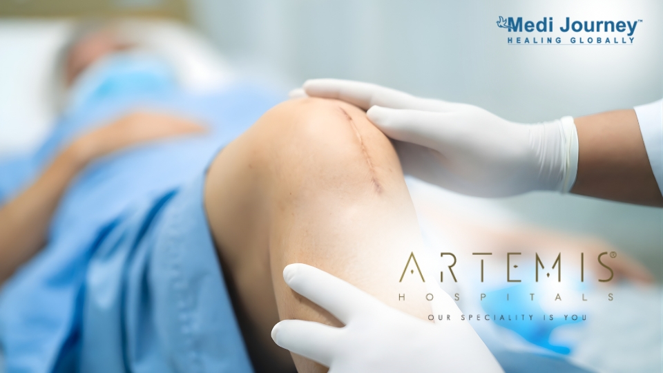 Best Knee Replacement Surgeons in Artemis Hospital Gurgaon
